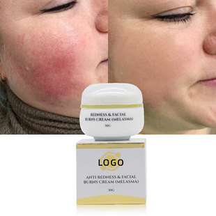 �S������˪�aˮ�̝��沿���w�p���TĨ���������ۺ��o͸����˪OEM