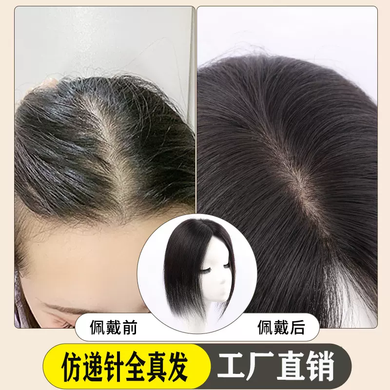 假发片女头顶稀少遮白发增发量蓬松真发颅顶无痕一片式递针补发片