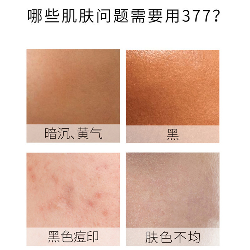 377 ホワイトニング エッセンス、保湿、保湿、濃い黄色、肌のトーンを改善、美白、そばかす除去、高濃度ナイアシンアミド オリジナル ソリューション|undefined