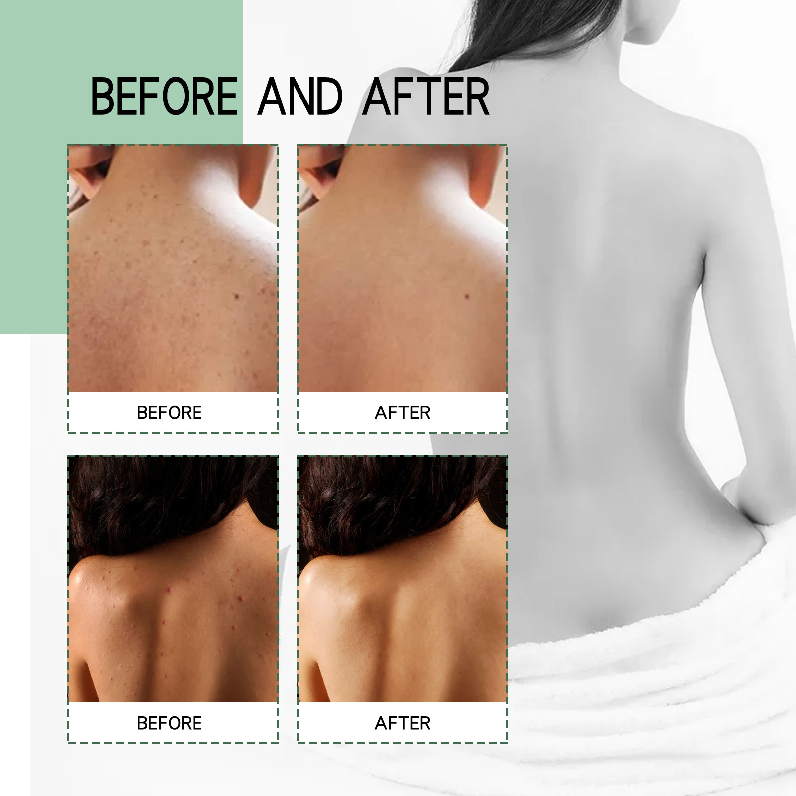 EELHOE Body Removing Cleaning Deeply Cleans Back Arm to Lighten and Acne Moisturizing spray_voghion.com