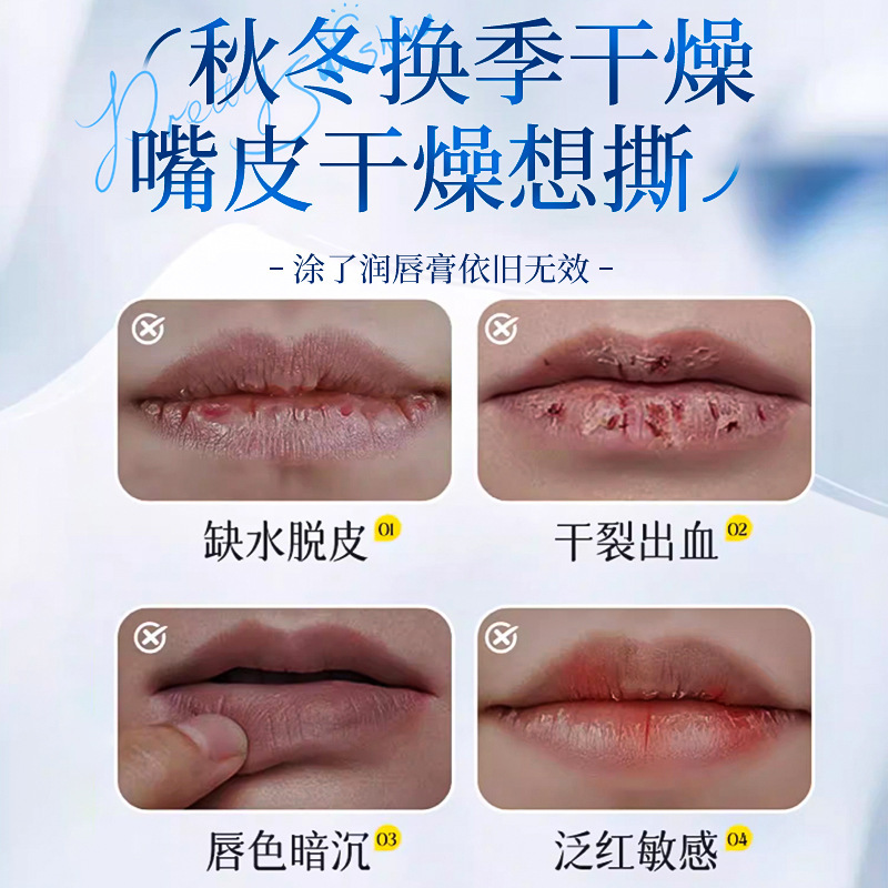 LVFEI焕彩唇部精华蜜质地细腻保湿滋润水嫩补水丰盈滋养改善干燥|undefined