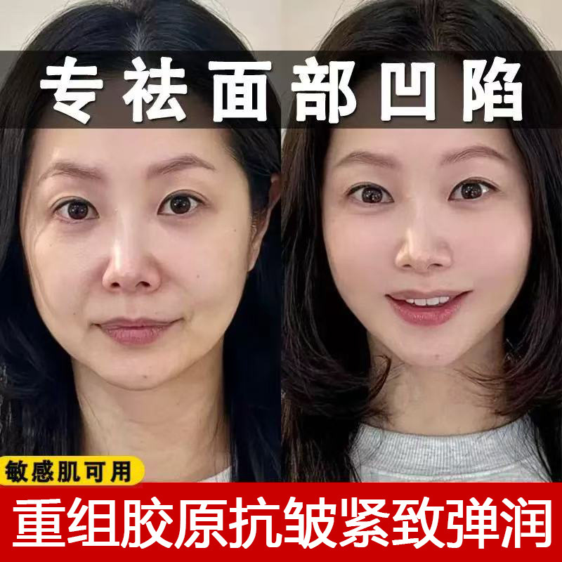 Collagen Filling Cream, Anti-Wrinkle Firming Cream, Anti-Aging Cream, Anti-Aging Cream for Forehead Wrinkles, Anti-Aging Cream for Filling Sunken Areas, Skin Rejuvenation Cream, Restructuring Cream