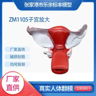 厂家供应ZM1105子宫放大模型生物教学模型医患交流模型现货
