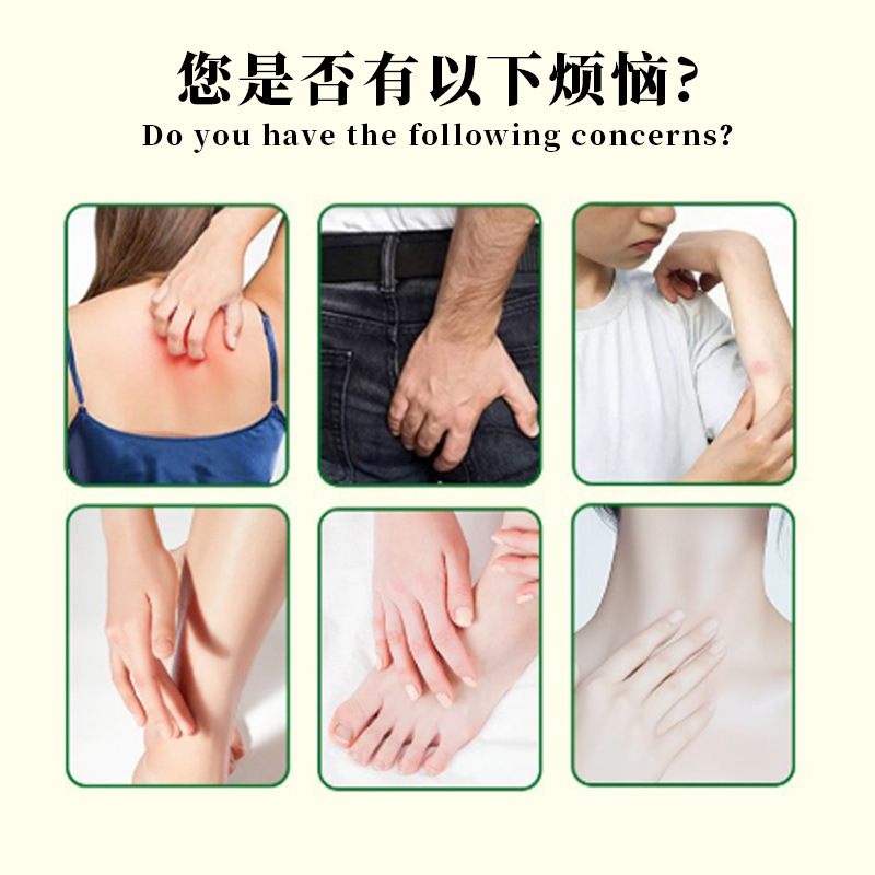 香港大药房真菌王草本乳膏手足起水泡手痒干裂水泡脱皮止痒护理膏|undefined