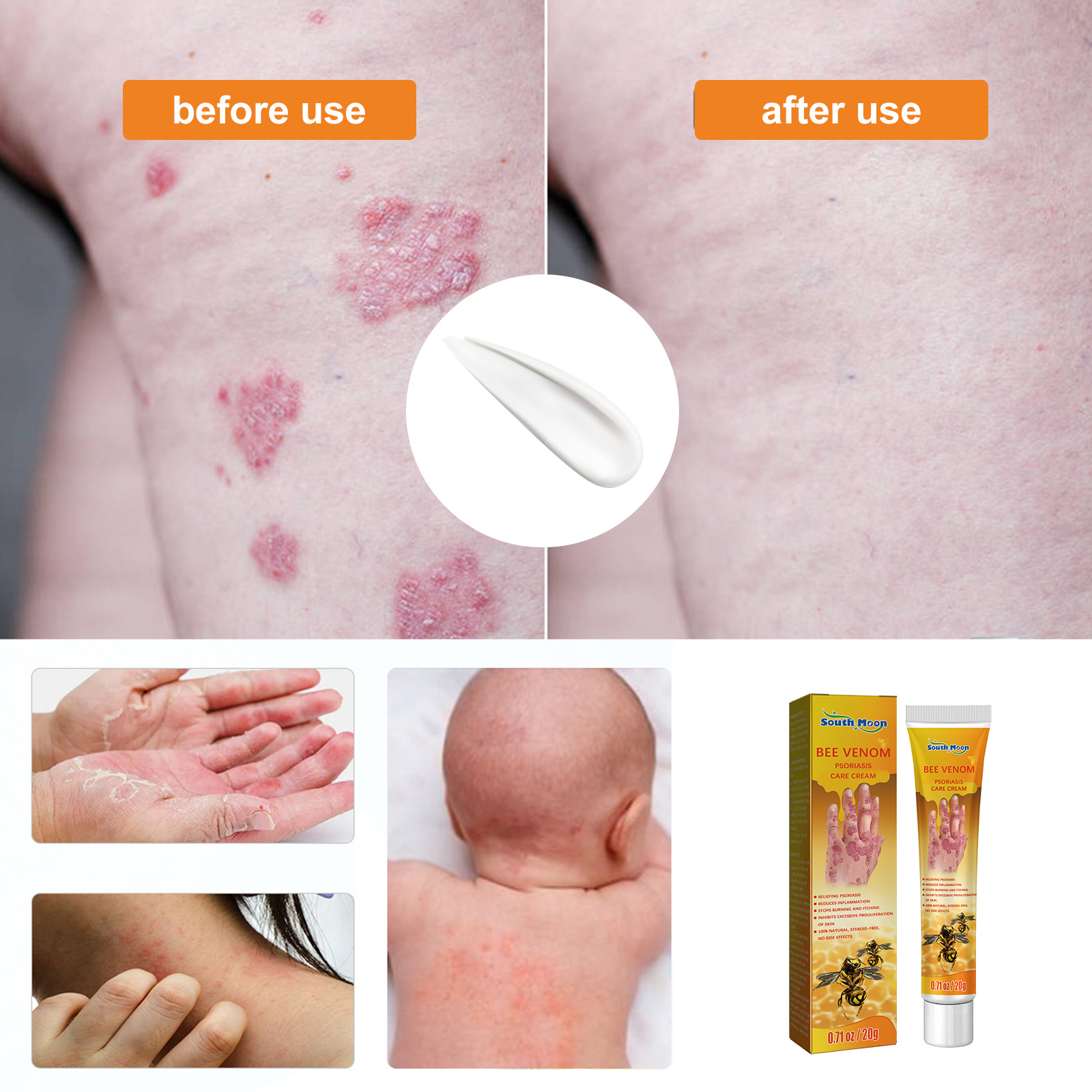 South Moon Skin Repair Cream relieves skin itching, repairs hand and foot, moisturizes skin and relieves itching care_voghion.com