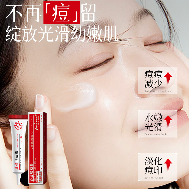 Jingchun Secret 鎮静抗ニキビクリームは、ニキビを除去し、ニキビ跡を薄くし、ニキビを改善し、ニキビ跡を閉じ、さわやかでベタつかないニキビ跡を改善します。|undefined