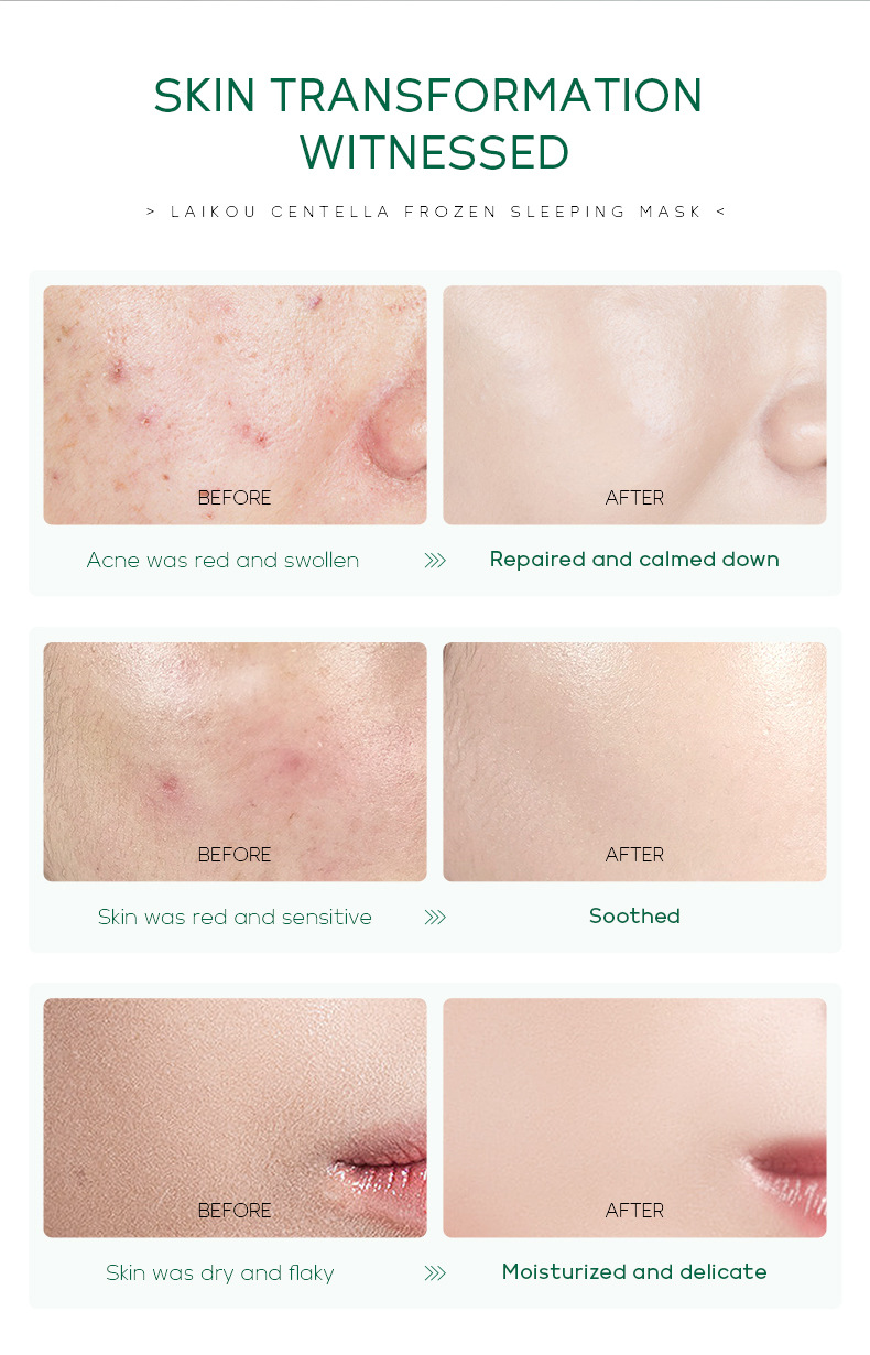 Wholesale cross-border LAIKOU Centella asiatica frozen Mask 100g application-based sleeping mask Hydrating Moisturizing Cleansing mask undefined