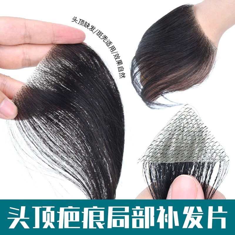 Forehead Hairline Fake Bangs, Sideburns, Replacement Hair Pieces, Full Human Hair, Biological Scalp Scar Patch Wig