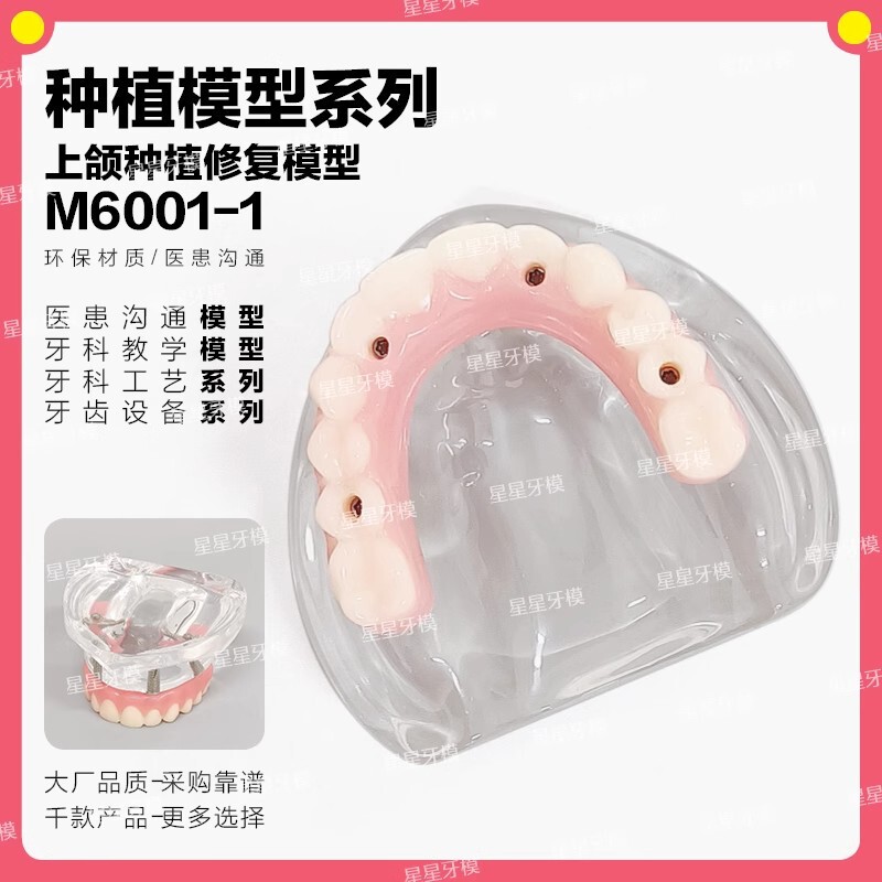 Oral Teaching Simulation Practice Mold Dental Maloon Bridge Denture Upper and Lower Jaw Implant Restoration Tooth Model