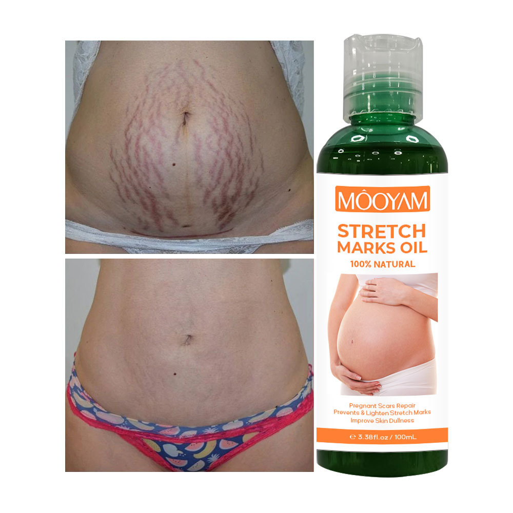 Cross-border Stretch Mark Oil pregnancy...