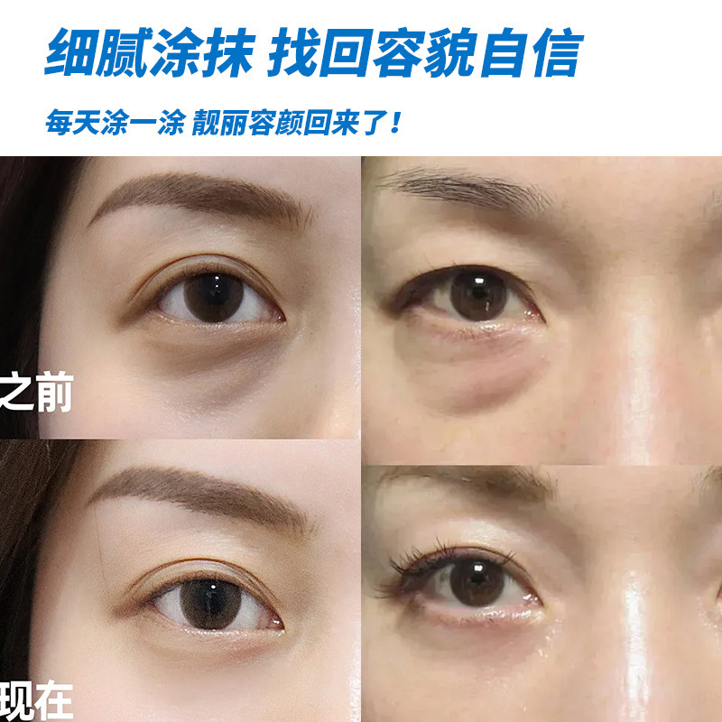 香港大药房眼袋膏眼部滋润膏黑眼圈膏眼袋清凉水润膏穴位膏批发|undefined