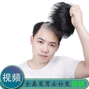 Men's Hair Replacement Wig Set, Top Hair Replacement, Forehead Baldness Replacement Pad, Hair Extension Flip-Up Wig, Real Hair Men's Hair Block