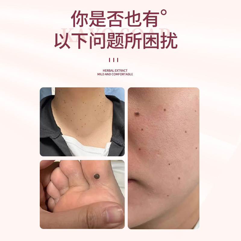 香港大药房克尤皂手工草本猴痘皂厂家批发肤康皂克尤皂|undefined
