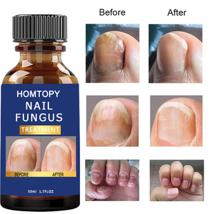 Cross-border new nail fungus repair nourishing liquid bright nail essence cleaning nail repair essence