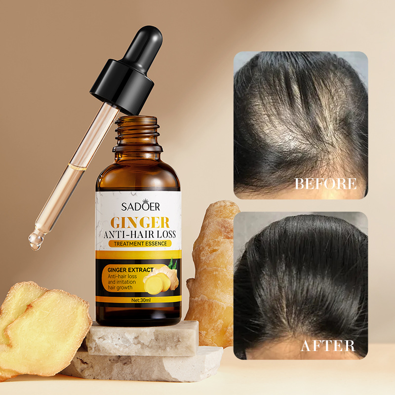 Todo en inglés SADOER Centynia Niacinamida Whitening Essence Serums Tono de piel antiarrugas Hidratante Transfronterizo al por mayor