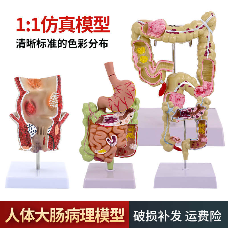 ��ѧ��������󳦲���ģ�ͳ�θֱ���̴�������ʳ��������᳦����