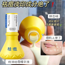 厂货通韩伦美羽控油祛痘精华液改善痘印痘坑护理保湿精华乳去痘痘