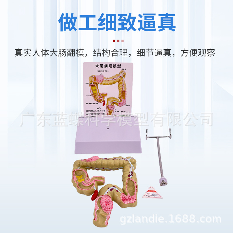 ��ѧ��������󳦲���ģ�ͳ�θֱ���̴�������ʳ��������᳦����