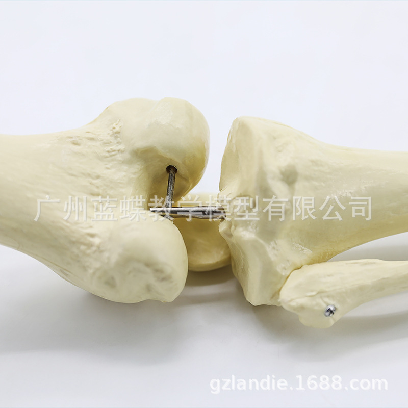 ���������֫�Ǵ��Źؽ� �Źؽ� ϥ�ؽڳ߹���ǹ���ģ��