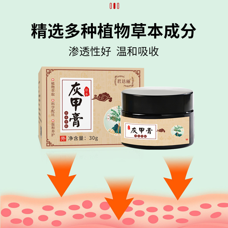 爪真菌クリーム、爪真菌ハーブクリーム、爪の厚さを除去する新しい明るい爪、爪の溝、爪真菌クリーム|undefined