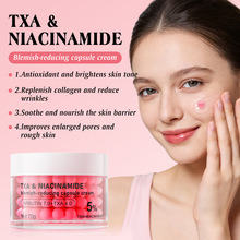 Ӣ�İ��׭h��TXA�������z��˪�沿���������Ӿ��A��˪���Q�羳