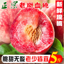 ���ں���Ѫ�Ү����r�����rˮ��5��������]�r���ԷN��Ʒ�N������