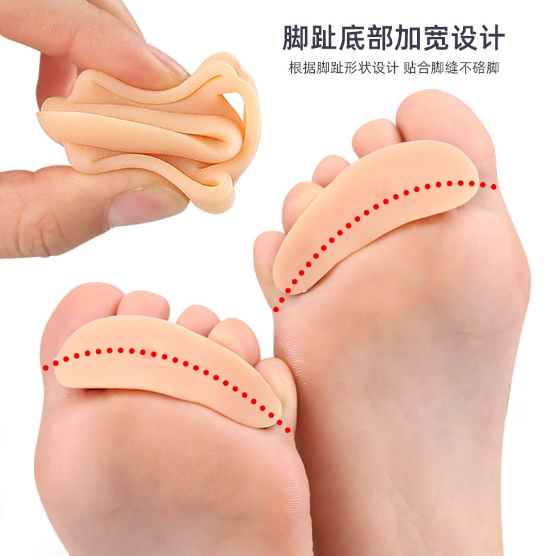 Трёх отверстий улитка перекрытие носок изгибается и деформируется Correct toe outer toe flap, молотковидный палец