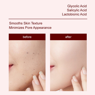 Hot-Selling Exfoliating Essence in Stock