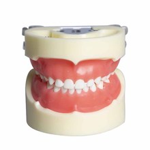 兒童乳牙模型 可拆卸齲齒模型兒童牙齒齲壞牙粒 口腔教學演示牙模