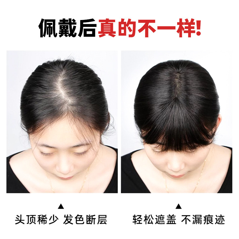 かつらの女性の頭の上に髪がふわふわしています。|undefined