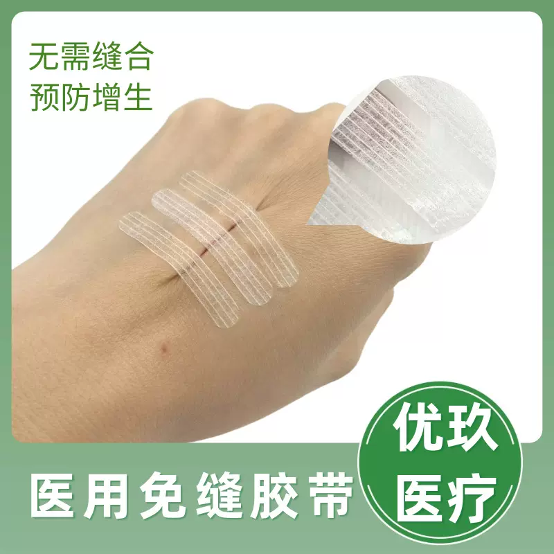 伤口免缝胶带术后创口缝合愈合贴吻合器拉合胶布伤口免缝减张贴