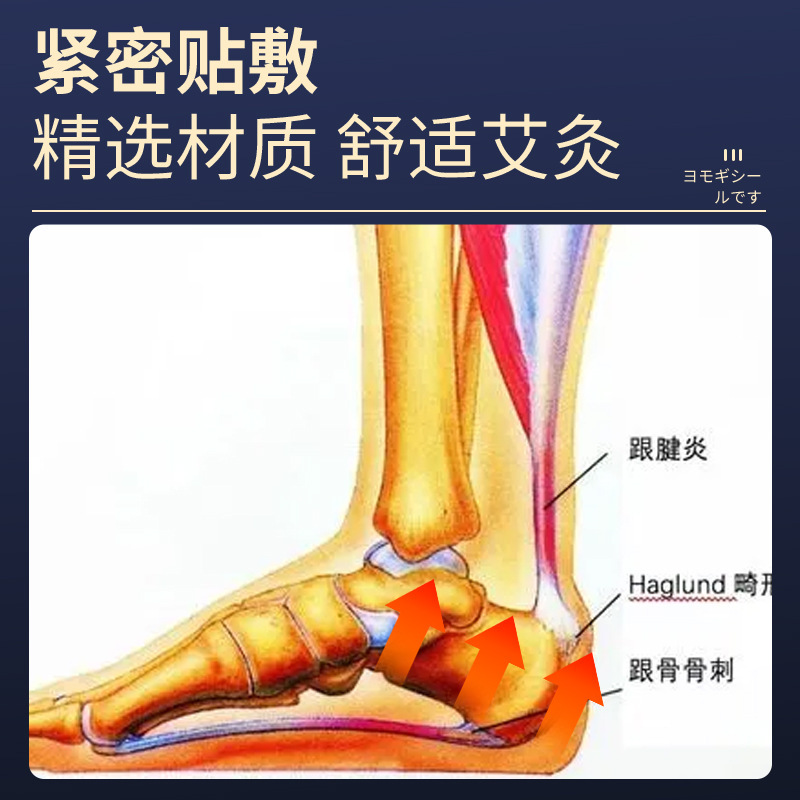 明野製薬の足とかかとの痛みは足首の関節にくっついて足とかかとの痛みをくっつけます。|undefined