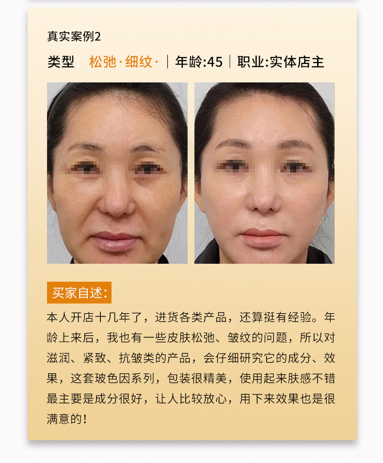 24-10-24玻色因面霜详情页优化_18.jpg