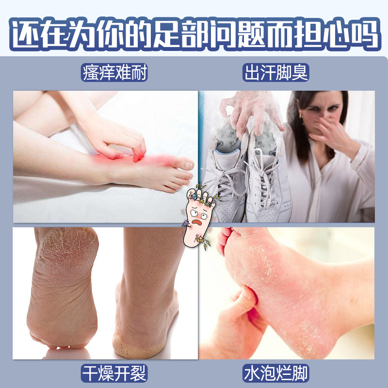 香港薬局ウルフポイズンフットクレンジングスプレー腐った足ピーリング水虫スプレーフットケアメーカー足臭水|undefined