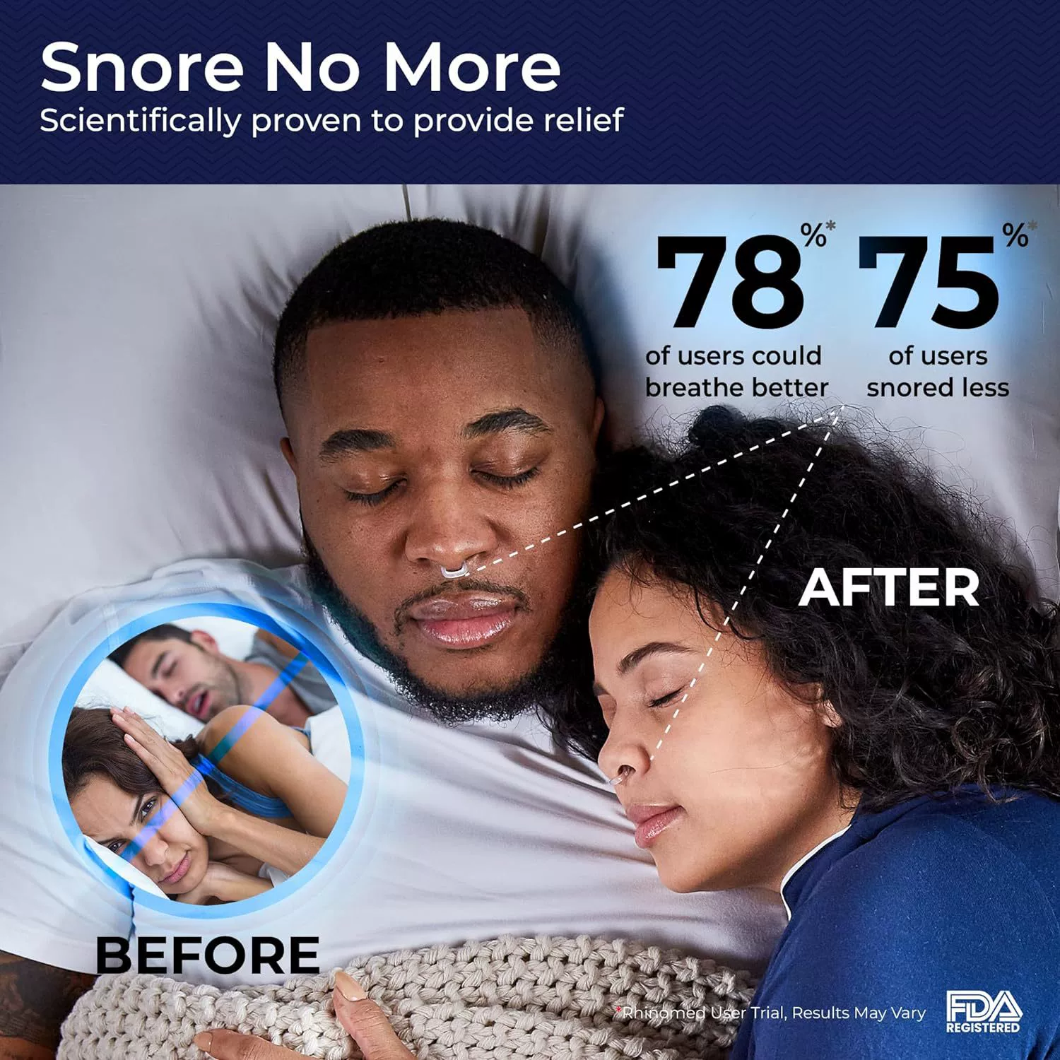 Безшумный носовой против Snoring Дилятор
