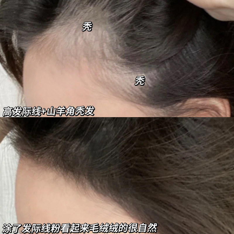 Hairline Contouring Shadow Powder Modification Filling Forehead Hairline Re-Hair Cross-Border Beauty Novice Friendly Cosmetics