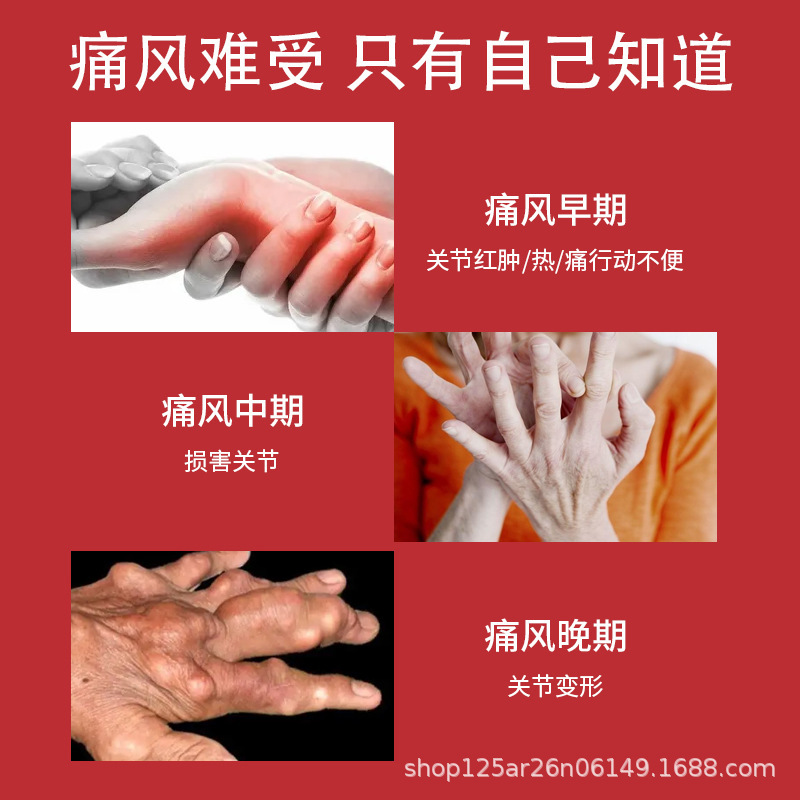 日本痛風消晶膏風指足腱鞘結晶除去腫脹湿風関節湿寒痛卸売り|undefined