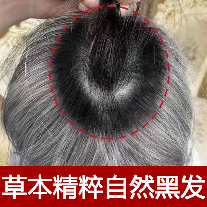 何首乌白转黑精华液白发转黑发营养液滋养毛囊养发护发防脱育发液|undefined