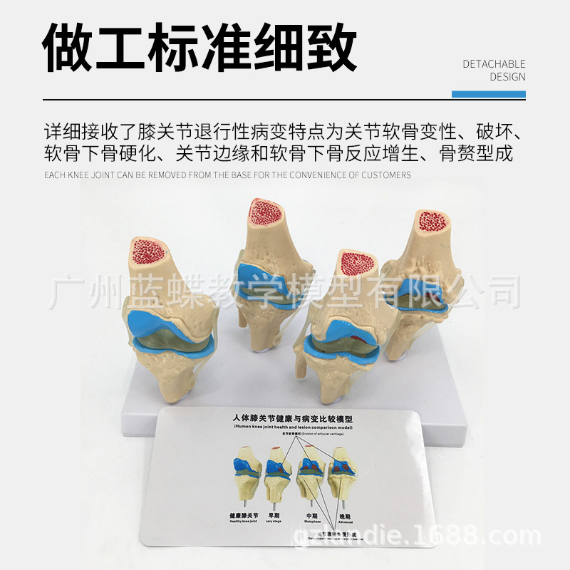 ���岡��ϥ�ؽ�ģ�� ��̬ϥ�ؽ������� ϥ�ؽ� ϥ�ؽھ�������ͨ