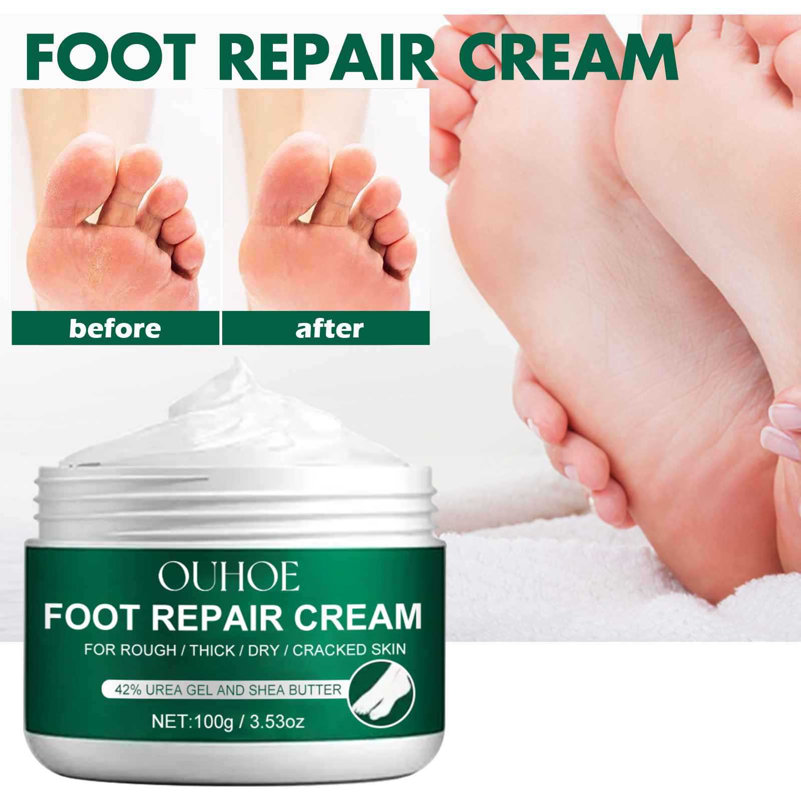 OUHOE Foot Repair Cream - Repair Heel Cracks, Dryness, Itching, Peeling, Nutrient-Rich Moisturizing Foot Care Cream