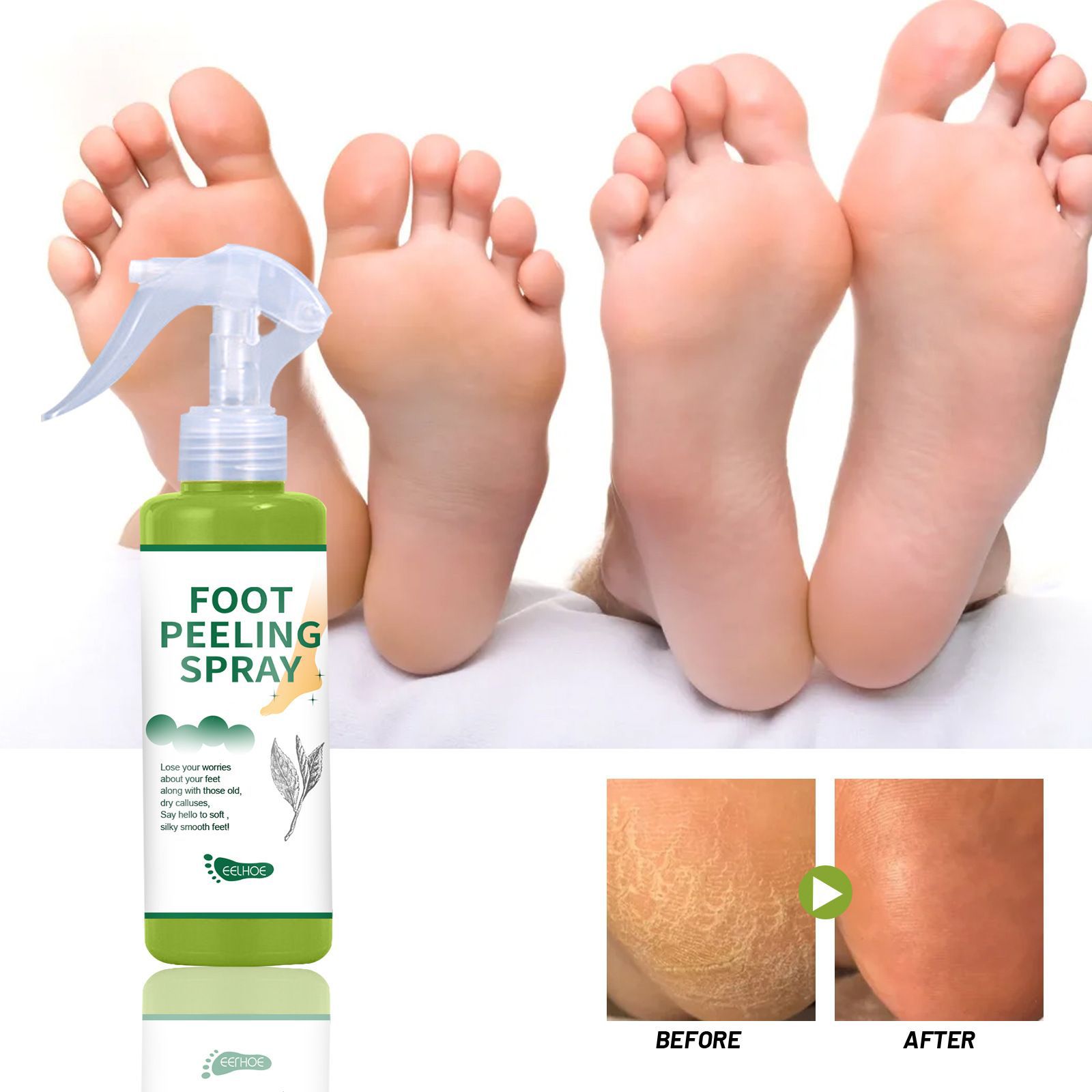 EELHOE Foot Care Spray - Foot Moisturizing Nourishing Skin Hydrating Anti-peeling and Dead Skin Care Spray
