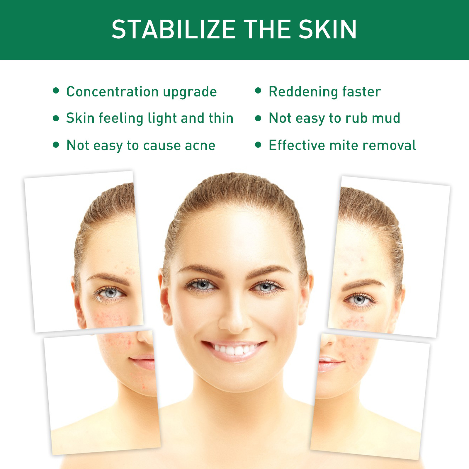 Jayswing Teebaumöl hellt Flecken op, befeucht sech, reparéiert Gesiichtsempfindlechkeet, Rötung an Akne, läscht Essenz_voghion.com