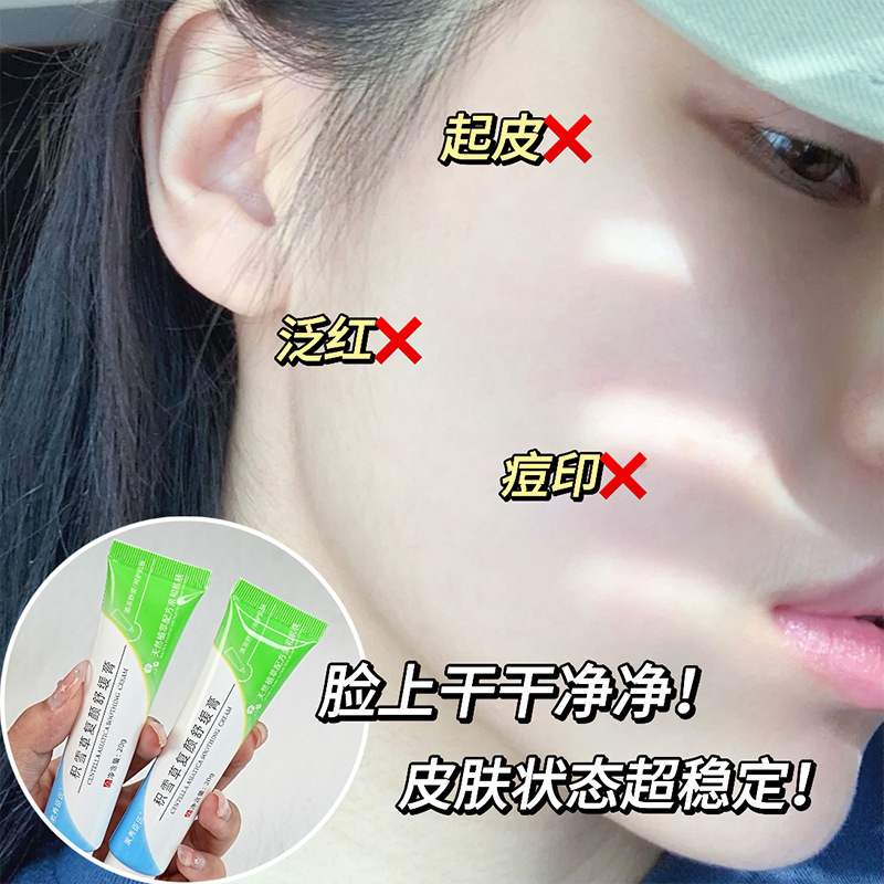 Suxiu Chen 's asiatica facial rejuvenecimiento crema para la piel hidratante crema acné rejuvenecimiento asiatica facial image 5