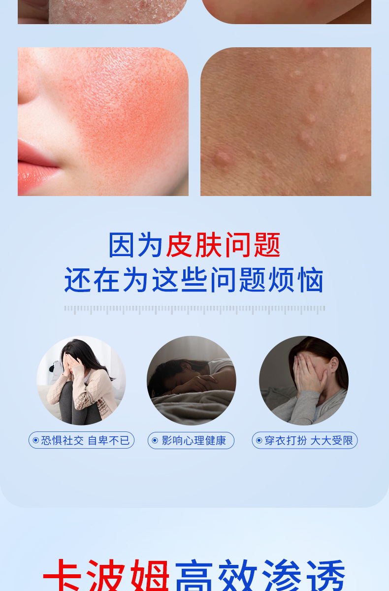 Dermatitis Eczema Gel External Herbal Topical for Itchy Skin and Joint Discomfort 黔械注准20252090184 specifications
