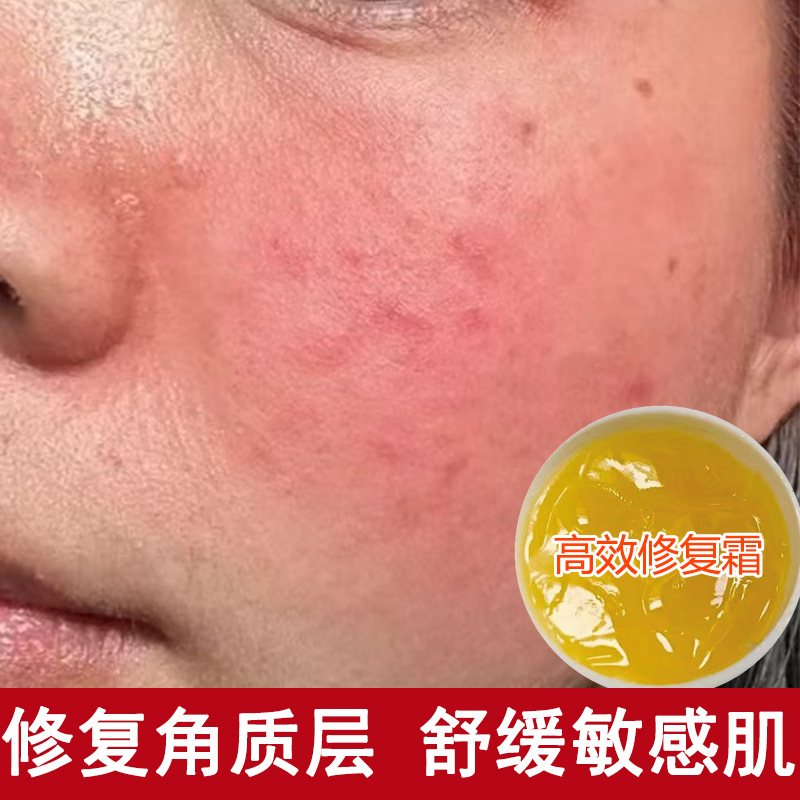 高效修复霜退红血丝修复敏感肌增厚角质层退红修复霜角质层修复膏