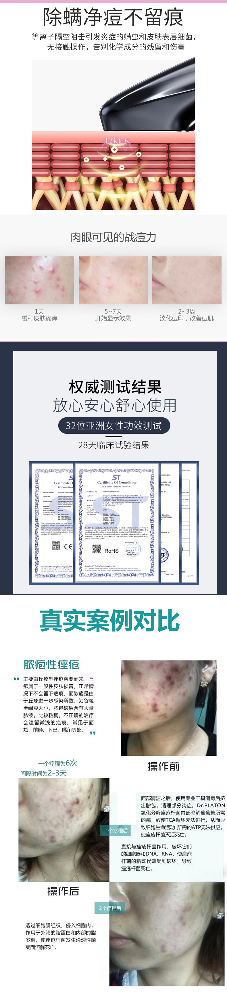 二代祛痘仪_01_06.jpg
