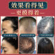 Nanjing Tongrentang vine thick ufa hair-raising liquid herbal hair-raising prevention and removal of Lejia old shop a generation of large quantity of hair excellent price