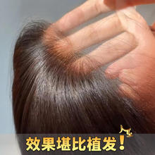 胎毛刘海假发女真人发头顶自然无痕增发量发际线假发片真人发丝