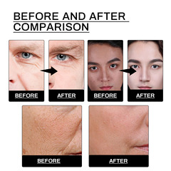 EAST MOON 男士面部套裝 保濕滋潤清潔面部抗皺緊緻修護肌膚套裝