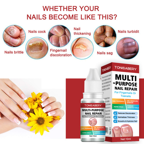 10ml Special Repair Solution for Onychomycosis Hand and Foot Care Nourishing Repair Solution Moisturizing Smoothing Nail Polishing Solution